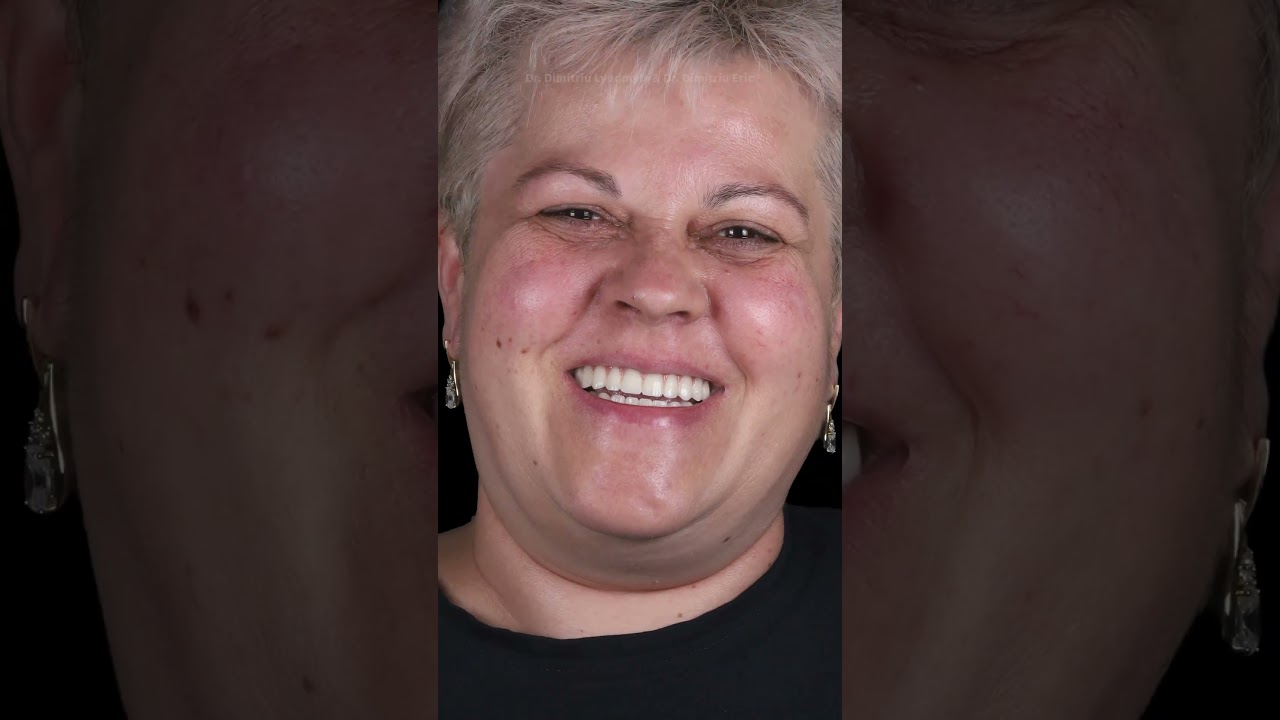 Full-mouth rehabilitation | cinematic case presentation | DentiClips