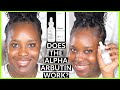 THE ORDINARY ALPHA ARBUTIN| DOES IT REALLY WORK FOR HYPERPIGMENTION AND DARK SPOTS? JWILLSCOOL