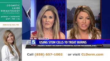 Using Stem Cells to Treat Burns