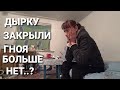 НАВЕСТИЛ ЛЮДМИЛУ//СКОРО ОПЕРАЦИЯ 😷ЧТО БУДЕТ С ЛЮДМИЛОЙ ДАЛЬШЕ....?