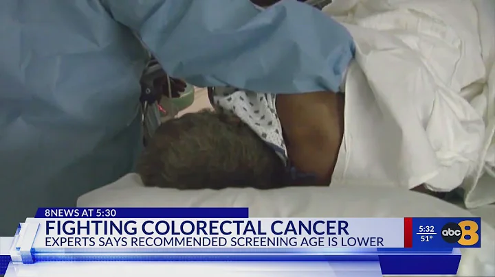 Virginia doctors share best strategies for preventing colorectal cancer