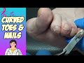 Curved Nails and Curved Toes - Groovy Music