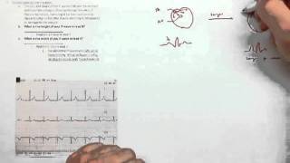 ECG Library Supplement (Hennager AP2 ECG Lab).mov