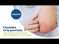 Lets talk  leczma et psoriasis  4 la prvention  multipharma