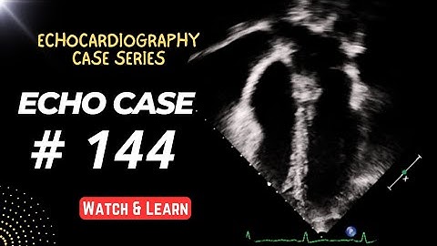 Echo Case 144: Echocardiography For Beginners