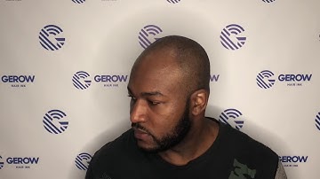 New York City’s leading ScalpMicropigmentation Clinic