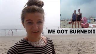 WE GOT TERRIBLE SUNBURN!! | Hampton Beach Vlog 3