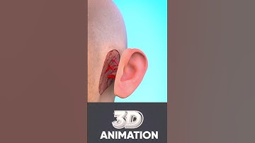 When your ear is cut off ?😱 || #shorts  #viral #3danimation #ytshorts #animation #treatment #surgery