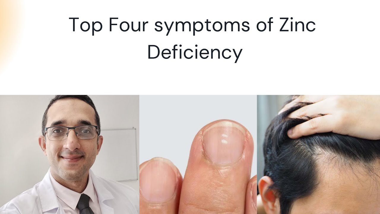 8 Zinc Deficiency Red Flags That Your Body is Silently Screaming. - YouTube