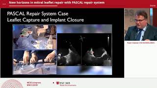 PASCAL repair system - New Horizons in mitral leaflet repair | Edwards Lifesciences symposium at ESC