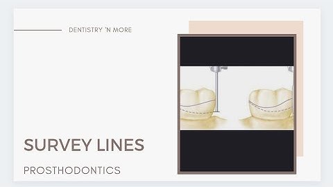 SURVEY LINES(PROSTHODONTICS)