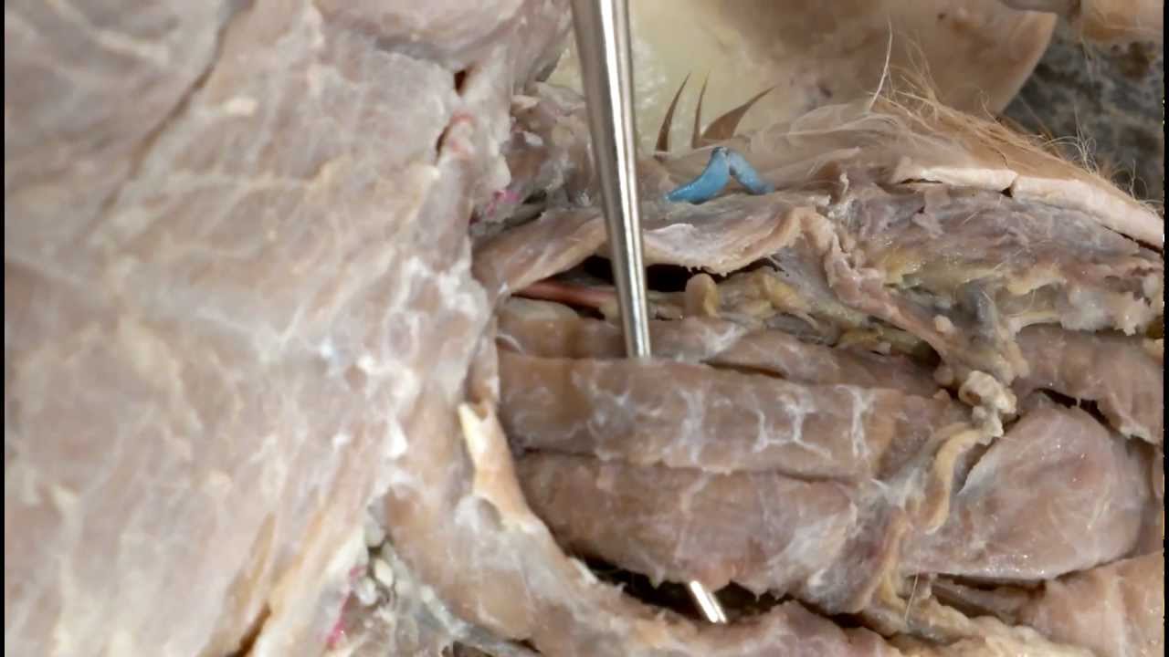 Cat Dissection- Neck Muscles - YouTube