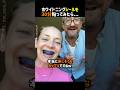 ホワイトニングシールを30分貼ってみたら...#海外動画 #ホワイトニング #おもしろ動画