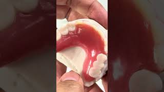 acryGrip partial that we just completed in my lab for Dr. Marlen Martirossian in New Jersey