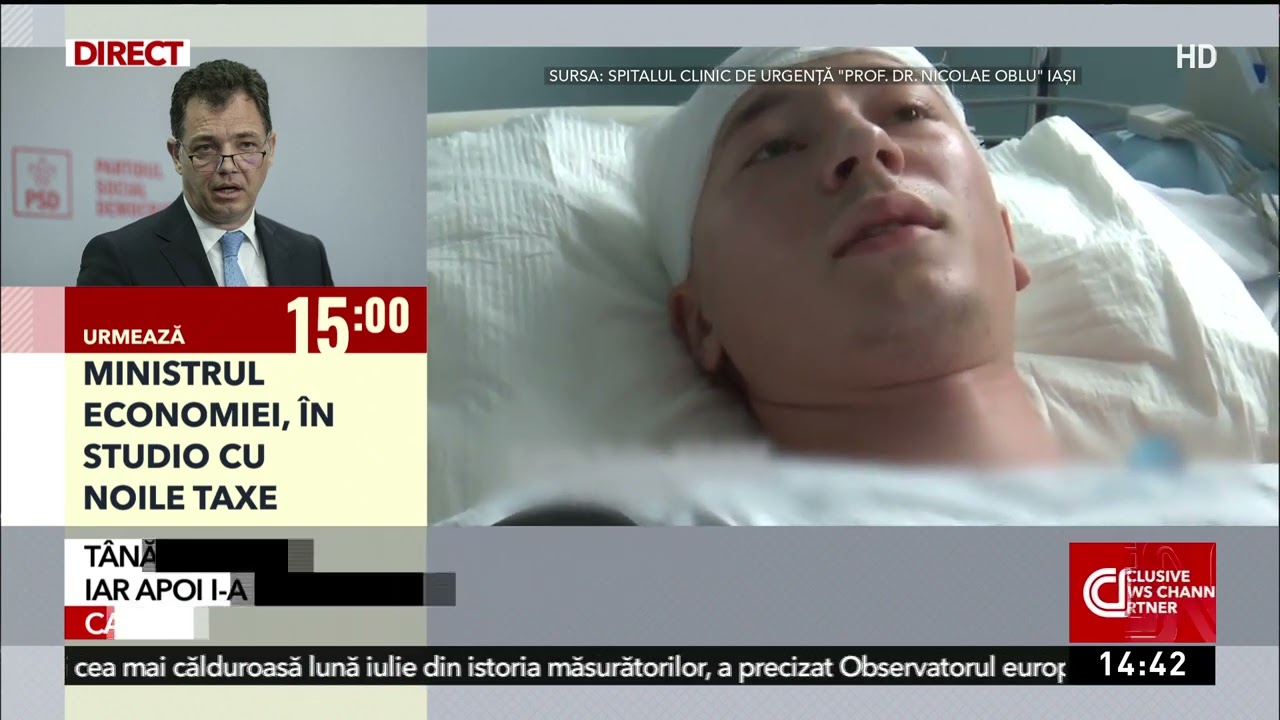 Și-a urmat visul cu orice preț! Carlo, tânărul cu tumoare pe creier, și-a dat licența la spital