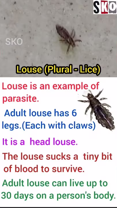 Louse(Plural:Lice)||Example of a parasite||Head Louse||Louse is an example of parasite#sko#shorts