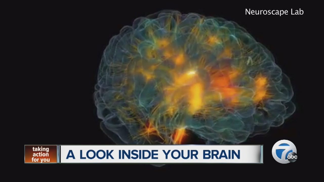 A 3d Look Inside Your Brain With Glass Brain