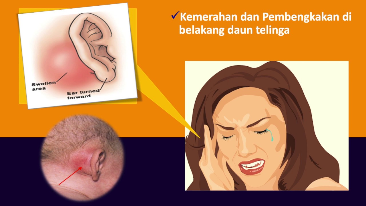 Komplikasi infeksi telinga ?