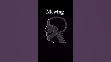 1 year mewing (insane change) #mewing #shorts