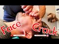 DOUBLE CRANIAL FACIAL RELEASE ~ SUCCESS STORY ~ BREATHING RESTORED!