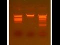 Restriction Digestion - Amrita University