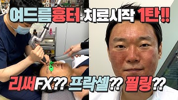 슈퍼프락셀   리써Fx   레드필 (여드름흉터 치료 1탄!!)