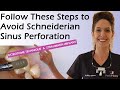 Follow these steps to avoid schneiderian membrane perforation during sinus lift