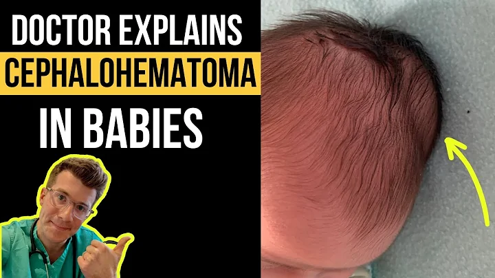 Doctor explains Cephalohematoma in babies - including causes, pictures, treatment and more! - DayDayNews