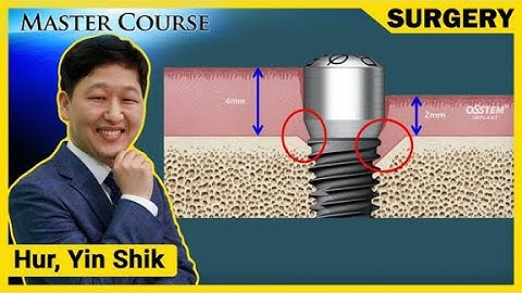 [Master Course Season2 - SURGERY] Introduction of peri implant soft tissue