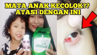 MATA ANAK KECOLOK MAINAN | INI SOLUSINYA | KHANZA FAMILY