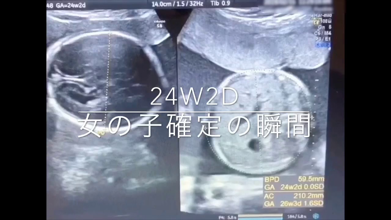 妊娠7ヶ月 女の子確定の瞬間 3d4d Youtube