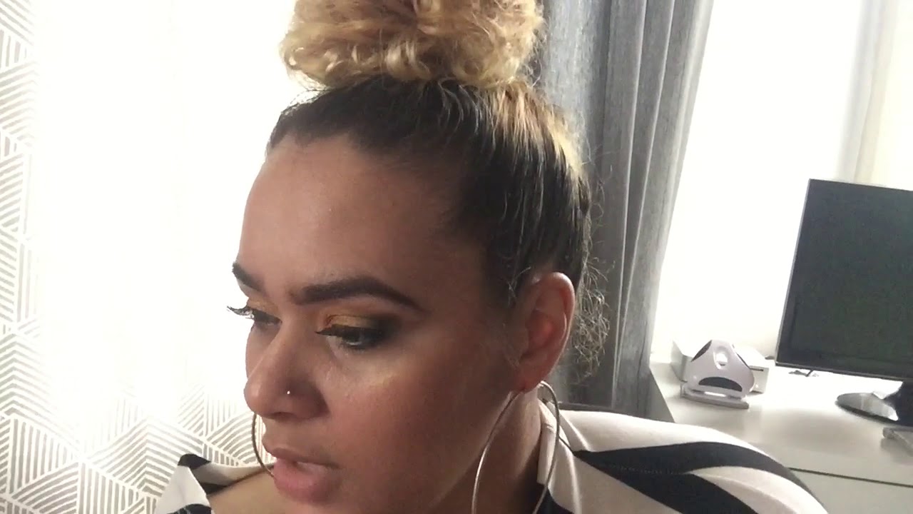 Yily (Part 1): i'm back from the DR 8weeks post op - YouTube