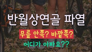 반월상연골파열 시리즈7  반월상연골파열 통증 부분은?