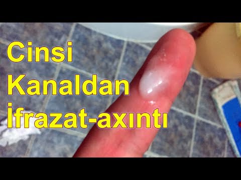 Video: Sidik ifrazı nə vaxt nəzərdə tutulur?