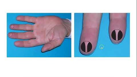 CC - Phlebotomy Handbook Chapter 11