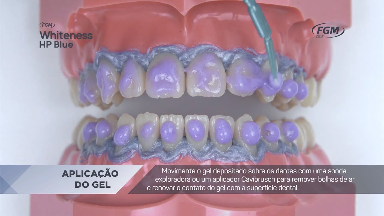 Passo a Passo Whiteness HP Blue