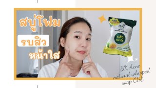 รีวิวสบู่ BK Acne Natural Whipping Soap C&E รบสิวหน้าใส สิวลดจริงมั้ยไปดู