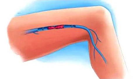 Où se trouve les veines dans les jambes ?