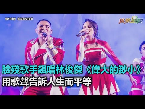 臉殘歌手飆唱林俊傑《偉大的渺小》　用歌聲告訴人生而平等｜三立新聞網SETN.com