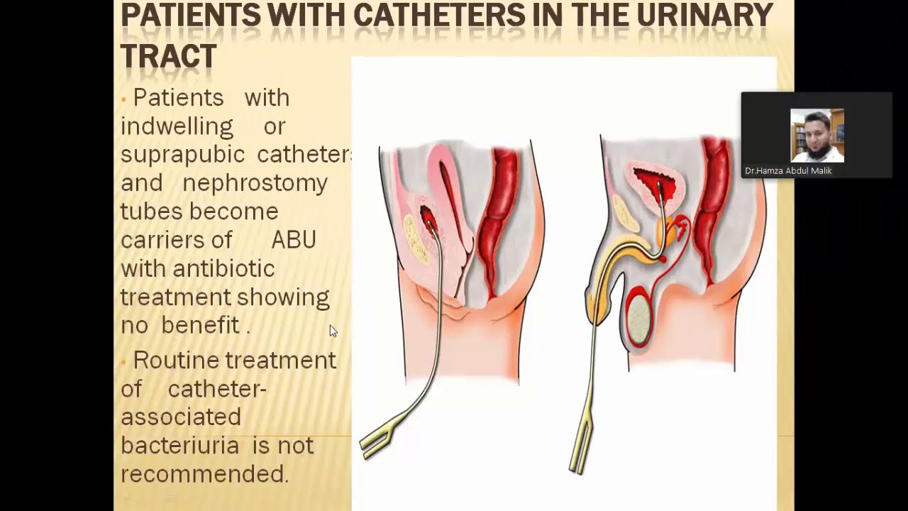 MS Urology Online Presentations at SIUT on 16th May 2020:EAU Guidelines on Urinary Tract Infection