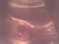 Regile & Crystal's baby due august 13th 2011!!