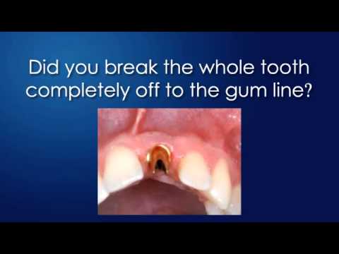 How are broken teeth fixed and treated?