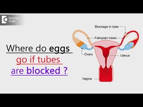 Where does the egg go if fallopian tubes are blocked? - Dr. Mangala Devi KR