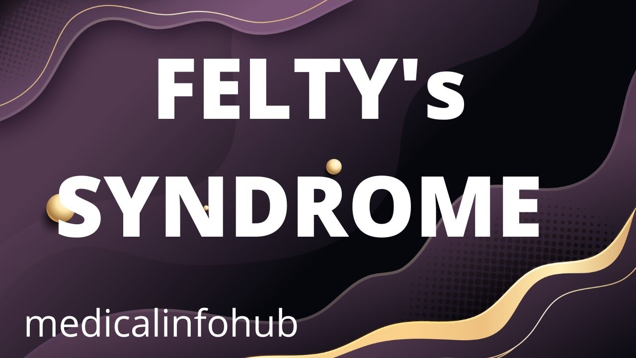 Felty's Syndrome Triad of Felty's Syndrome Splenomegaly II