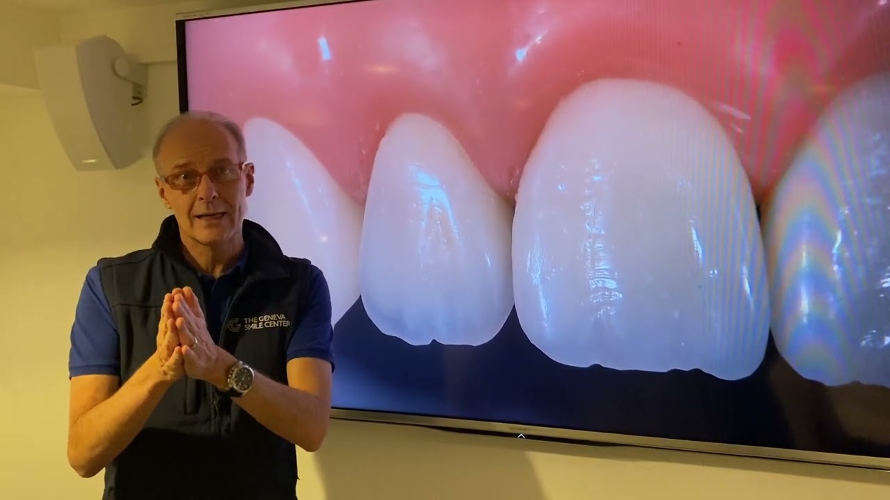 ANTERIOR BIO-ESTHETIC RESTORATIONS MASTER PROGRAM MODULE I