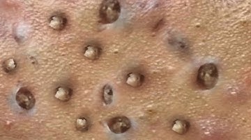 𝑨𝒄𝒉𝒊𝒆𝒗𝒆 𝑰𝒏𝒏𝒆𝒓 𝑷𝒆𝒂𝒄𝒆 𝑾𝒊𝒕𝒉 𝑻𝒉𝒆𝒔𝒆 𝑭𝒂𝒄𝒊𝒂𝒍 𝑪𝒍𝒆𝒂𝒏𝒔𝒊𝒏𝒈 𝑴𝒆𝒕𝒉𝒐𝒅𝒔 #90470814