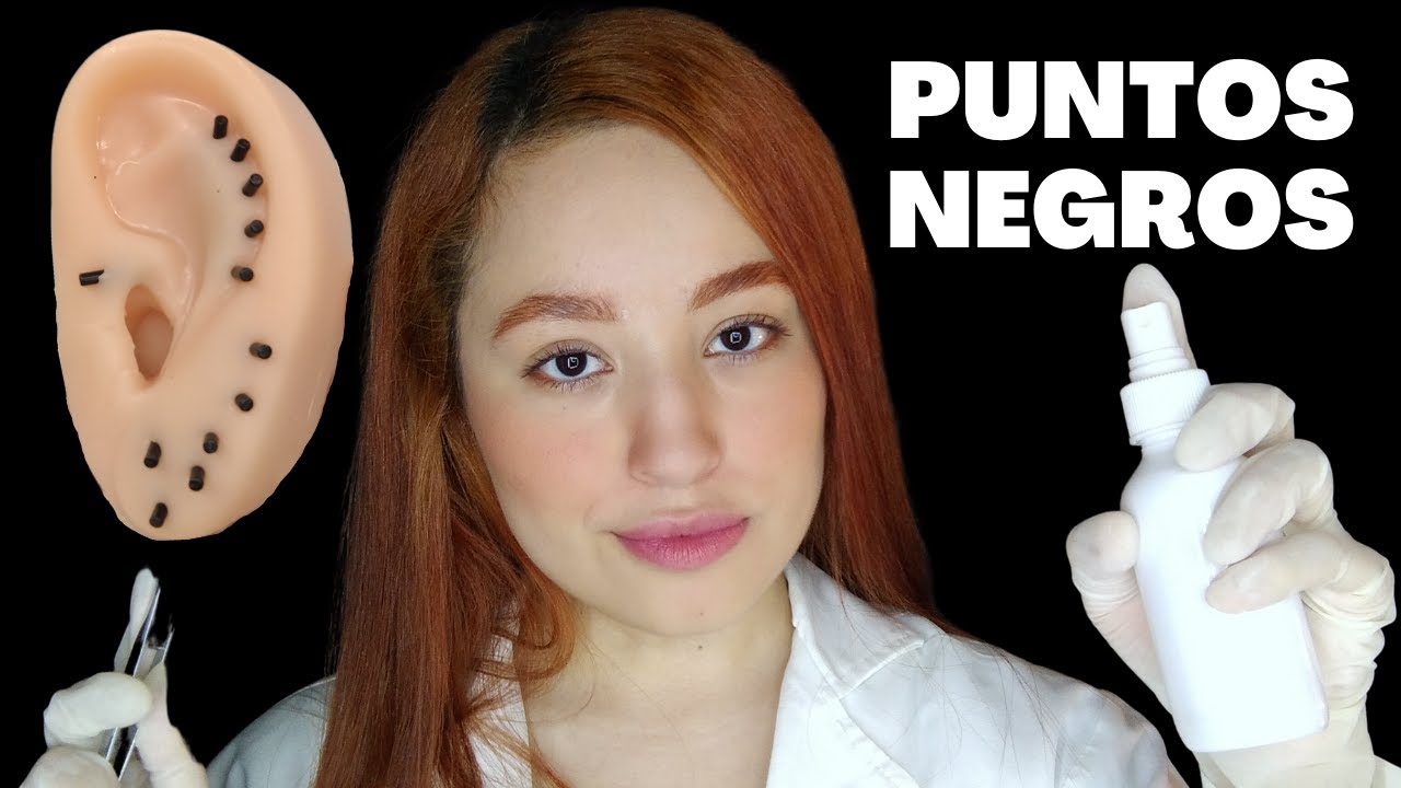 EXTRACCIÓN DE PUNTOS NEGROS | ROLEPLAY | ASMR Español