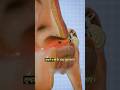 what happens when a fly enter in ear 👂#facts #3danimation #3d