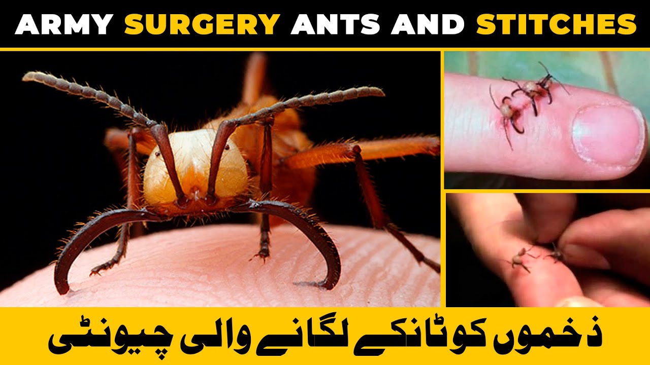 Army Ants Used As Stitches For A Wound Hindi Urdu Army Surgery Army Ants Used As Stitches For A Wound Hindi Urdu Army Surgery