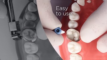 Palodent 360 Comparison I Dentsply Sirona